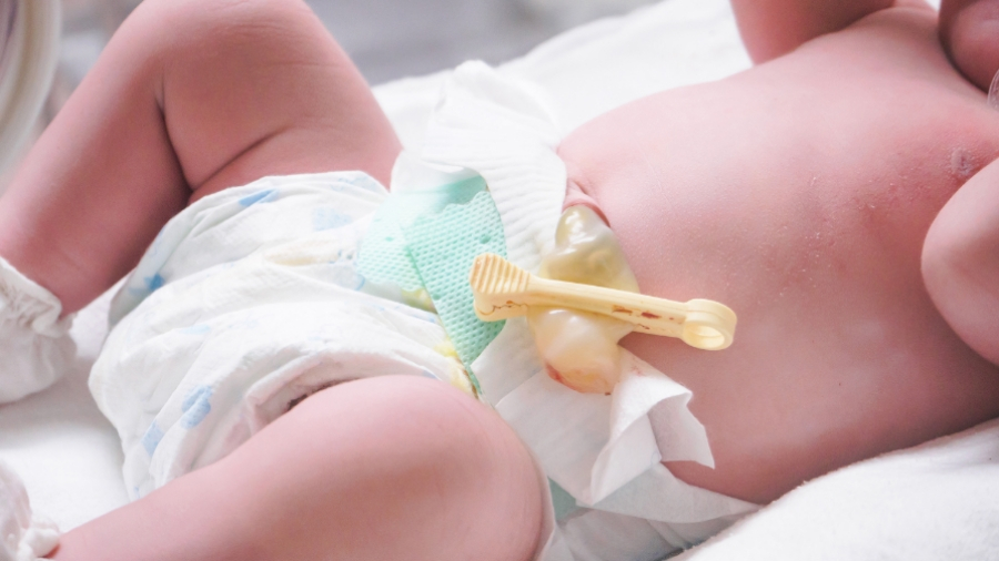 How the Umbilical Cord Saves Your Baby’s Life—and the Lives of Others